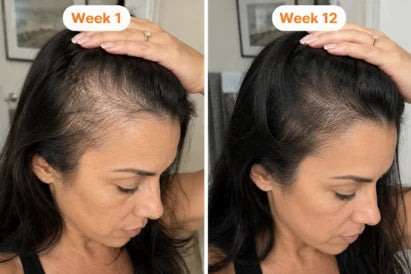 Scalp Moisturizing Essence for Daily Hair Care